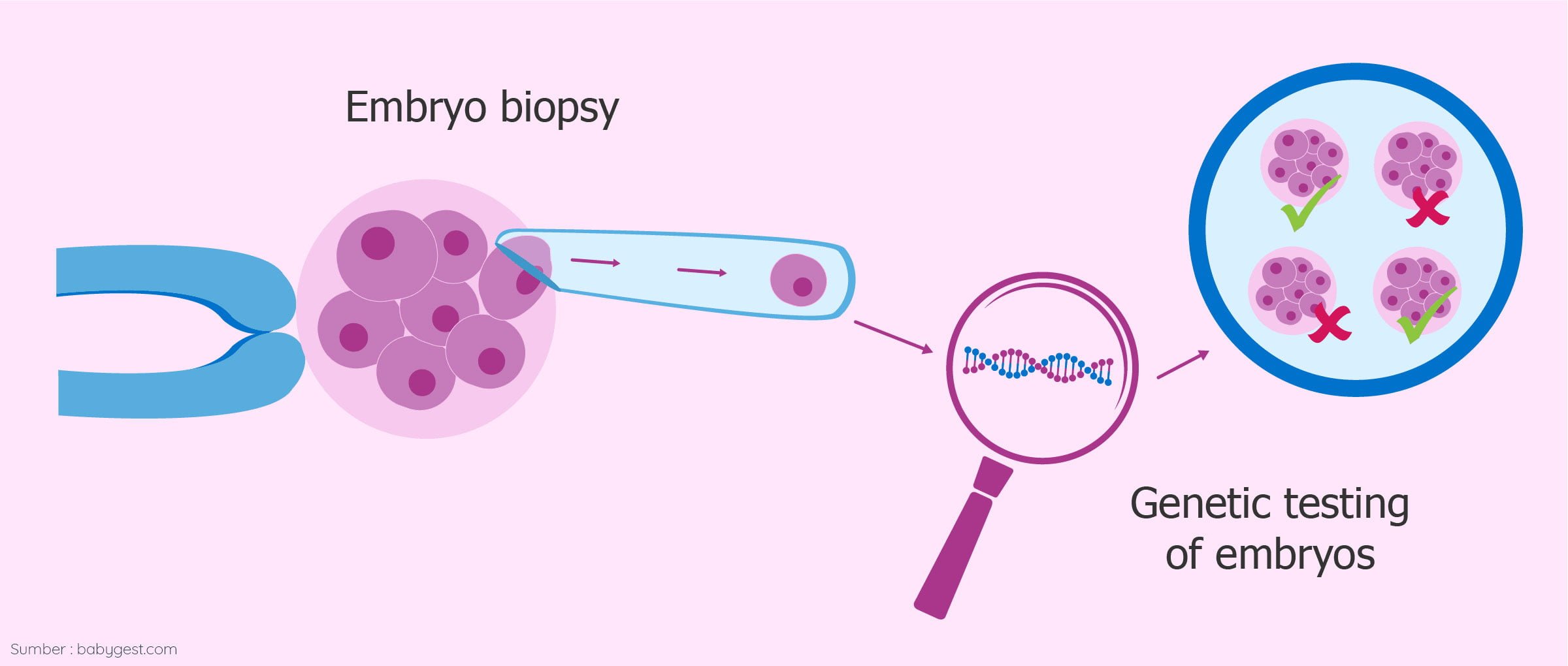 What-is-PGD-1